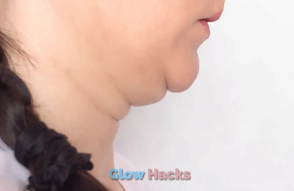 How To Get Rid of a Double Chin Fast