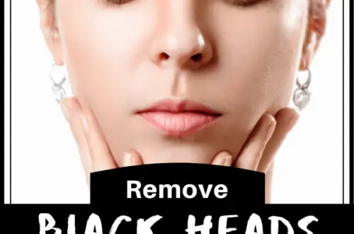 Remove Blackheads With Simple And Effective Trick
