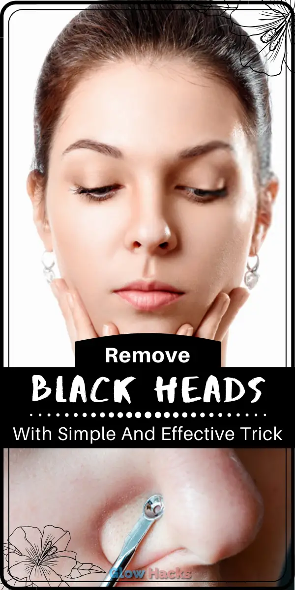 remove blackheads from nose